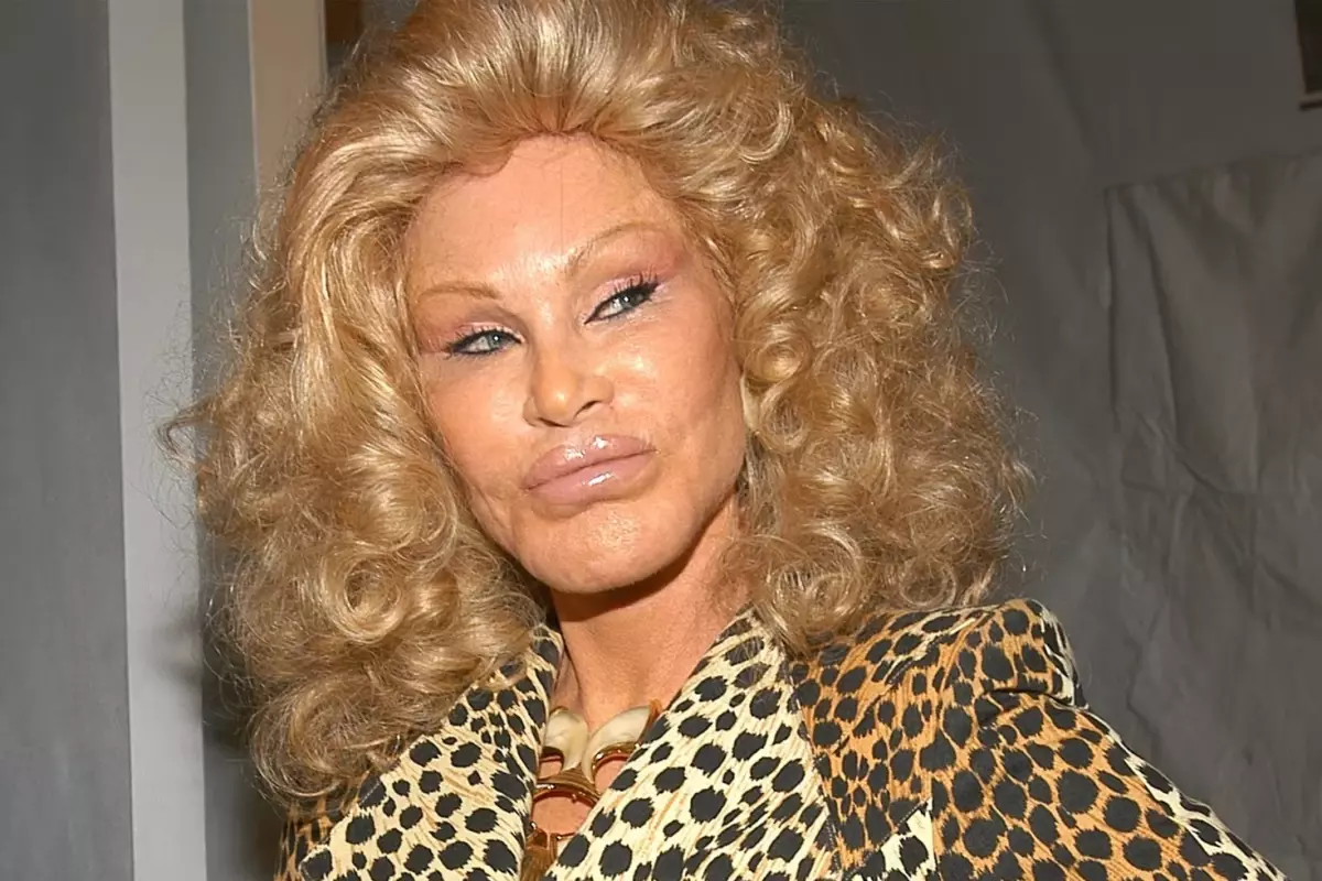 ‘Kedi Kadın’ lakaplı Jocelyn Wildenstein hayatını kaybetti